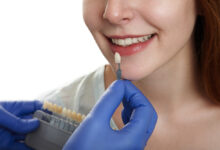 کدام برند کامپوزیت کمترین تغییر رنگ را دارد؟