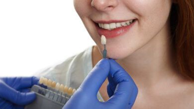 کدام برند کامپوزیت کمترین تغییر رنگ را دارد؟