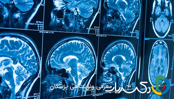 تومورهای مغزی چگونه بوجود می آیند ؟ از یک سلول تا یک توده