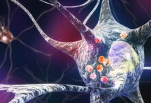 آیا پارکینسون بیماری خود ایمنی است ؟