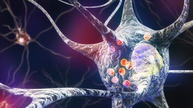 آیا پارکینسون بیماری خود ایمنی است ؟