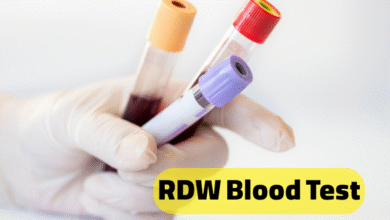 تفسیر مقدار RDW در آزمایش خون نوزاد