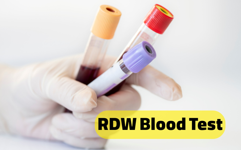 تفسیر مقدار RDW در آزمایش خون نوزاد