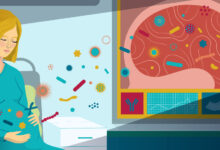 آیا اوتیسم در بارداری قابل تشخیص است ؟ راهنمای جامع مبتنی بر شواهد