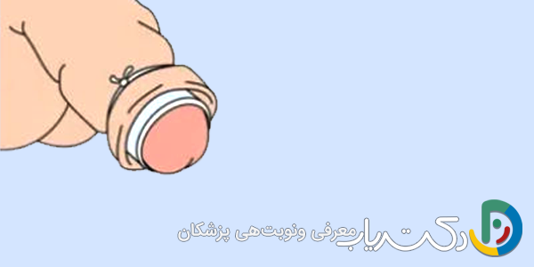بستن نخ مخصوص دور حلقه