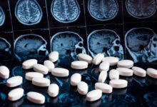 آیا آلزایمر خفیف درمان دارد ؟ نگاهی جامع به جدیدترین رویکردهای درمانی و مدیریتی