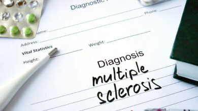 برای تشخیص ام اس چه آزمایشی باید داد ؟ از علائم تا آزمایشهای تخصصی
