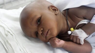 آیا هیدروسفالی کشنده است؟ بررسی کامل