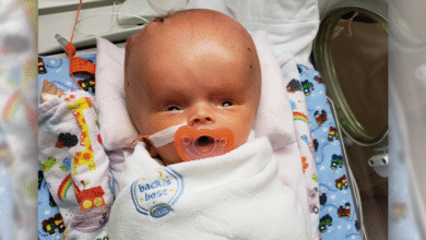 هیدروسفالی جنین چیست و در چند هفتگی مشخص میشود ؟