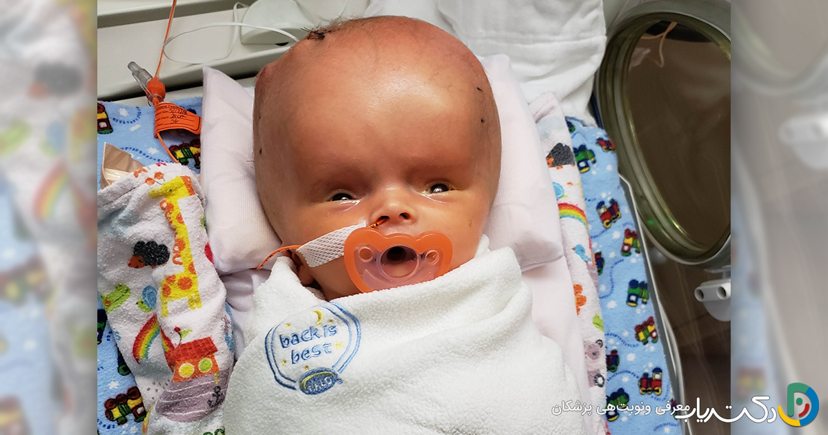 هیدروسفالی جنین چیست و در چند هفتگی مشخص میشود ؟