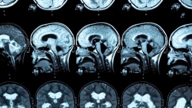 هیدروسفالی چگونه تشخیص داده میشود ؟