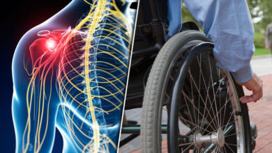 ام اس بعد از چند سال فلج می کند ؟ راهنمای جامع پیشرفت بیماری
