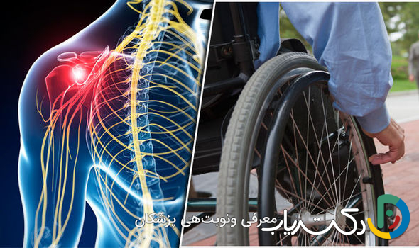 ام اس بعد از چند سال فلج می کند ؟ راهنمای جامع پیشرفت بیماری