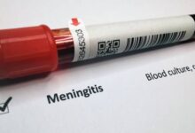 آیا مننژیت با آزمایش خون مشخص میشود ؟