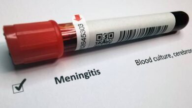 آیا مننژیت با آزمایش خون مشخص میشود ؟