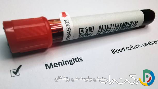 آیا مننژیت با آزمایش خون مشخص میشود ؟