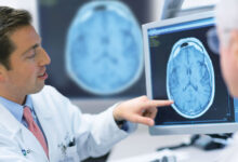 برای تشخیص ام اس به چه دکتری مراجعه کنیم ؟