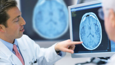 برای تشخیص ام اس به چه دکتری مراجعه کنیم ؟