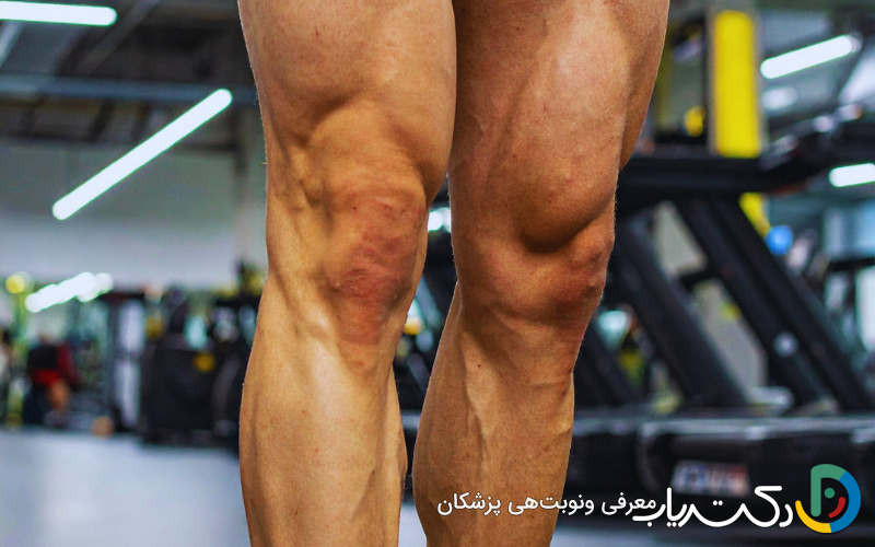 تاثیر راه رفتن رو به عقب بر تقویت عضلات پا و زانو