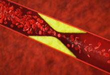 اگر کلسترول بالا دارید، این ۵ سبزی به سلامت قلب شما کمک می کنند