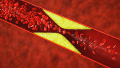 اگر کلسترول بالا دارید، این ۵ سبزی به سلامت قلب شما کمک می کنند