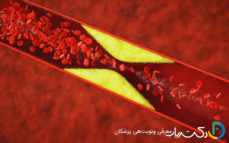 اگر کلسترول بالا دارید، این ۵ سبزی به سلامت قلب شما کمک می کنند