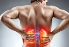 آیا سنگ کلیه باعث کمردرد میشود؟ راهنمای کامل تشخیص و تمایز علائم