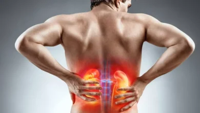آیا سنگ کلیه باعث کمردرد میشود؟ راهنمای کامل تشخیص و تمایز علائم