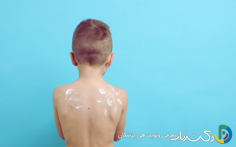 تفاوت هیدروکورتیزون و بتامتازون در کودکان و نوزادان و نواحی حساس بدن