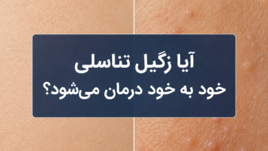 آیا زگیل تناسلی خود به خود درمان میشود؟