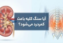 آیا سنگ کلیه باعث کمردرد میشود؟ راهنمای کامل تشخیص و تمایز علائم