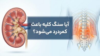 آیا سنگ کلیه باعث کمردرد میشود؟ راهنمای کامل تشخیص و تمایز علائم