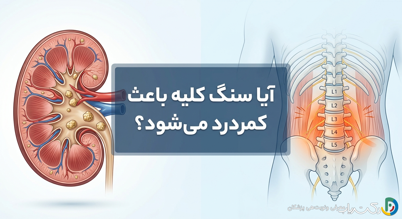 آیا سنگ کلیه باعث کمردرد میشود؟ راهنمای کامل تشخیص و تمایز علائم