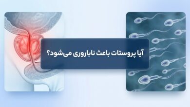 آیا پروستات باعث ناباروری میشود؟ (بررسی جامع رابطه سلامت پروستات و باروری)