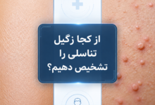 از کجا زگیل تناسلی را تشخیص دهیم؟ راهنمای کامل روشهای تشخیصی و آزمایشگاهی