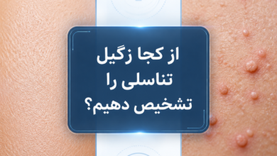 از کجا زگیل تناسلی را تشخیص دهیم؟ راهنمای کامل روشهای تشخیصی و آزمایشگاهی