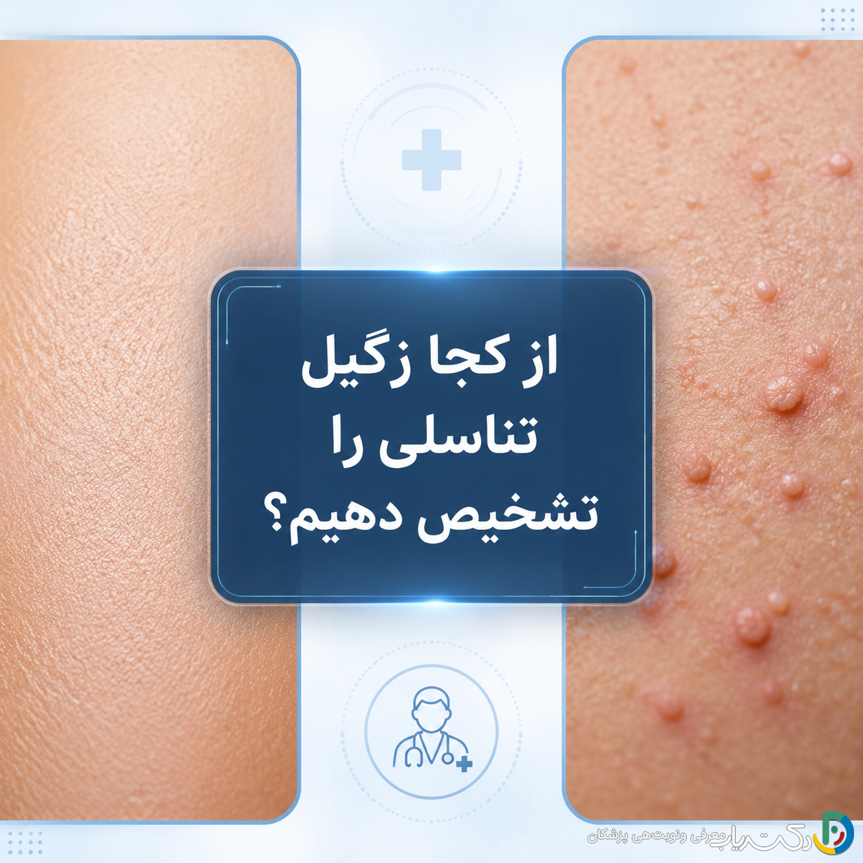 از کجا زگیل تناسلی را تشخیص دهیم؟ راهنمای کامل روشهای تشخیصی و آزمایشگاهی