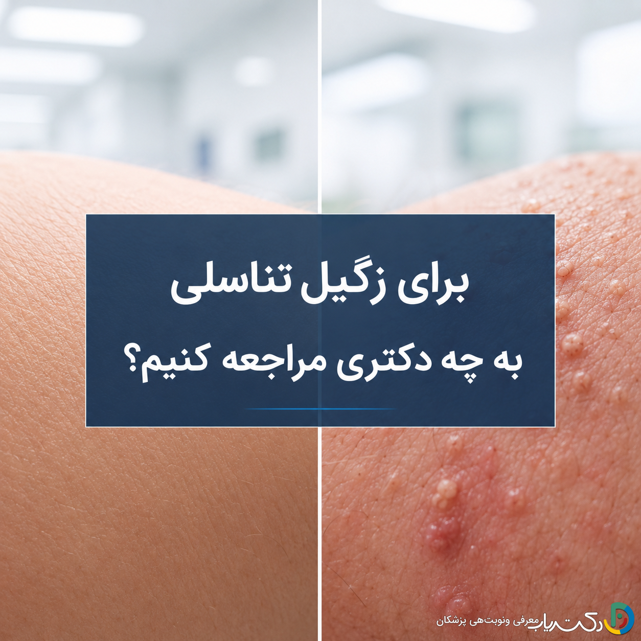 برای زگیل تناسلی به چه دکتری مراجعه کنیم؟ راهنمای انتخاب متخصص مناسب