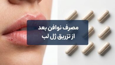 مصرف نوافن بعد از تزریق ژل لب: راهنمای جامع و نکات ایمنی