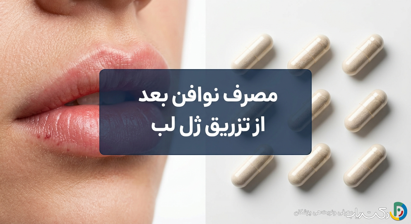 مصرف نوافن بعد از تزریق ژل لب: راهنمای جامع و نکات ایمنی - مجله دکتریاب