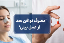 مصرف داروی نوافن بعد از عمل بینی: کنترل درد و کاهش عوارض