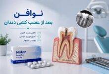 نوافن بعد از عصب کشی دندان (راهنمای جامع مصرف)