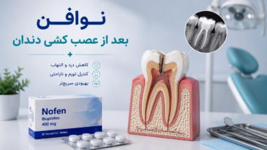 نوافن بعد از عصب کشی دندان (راهنمای جامع مصرف)