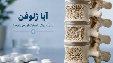 آیا ژلوفن باعث پوکی استخوان میشود؟ بررسی علمی و راهکارهای پیشگیری